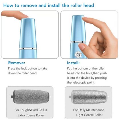 🔥Hot Sale - 50% OFF🔥Electric Feet Callus Remover⚡