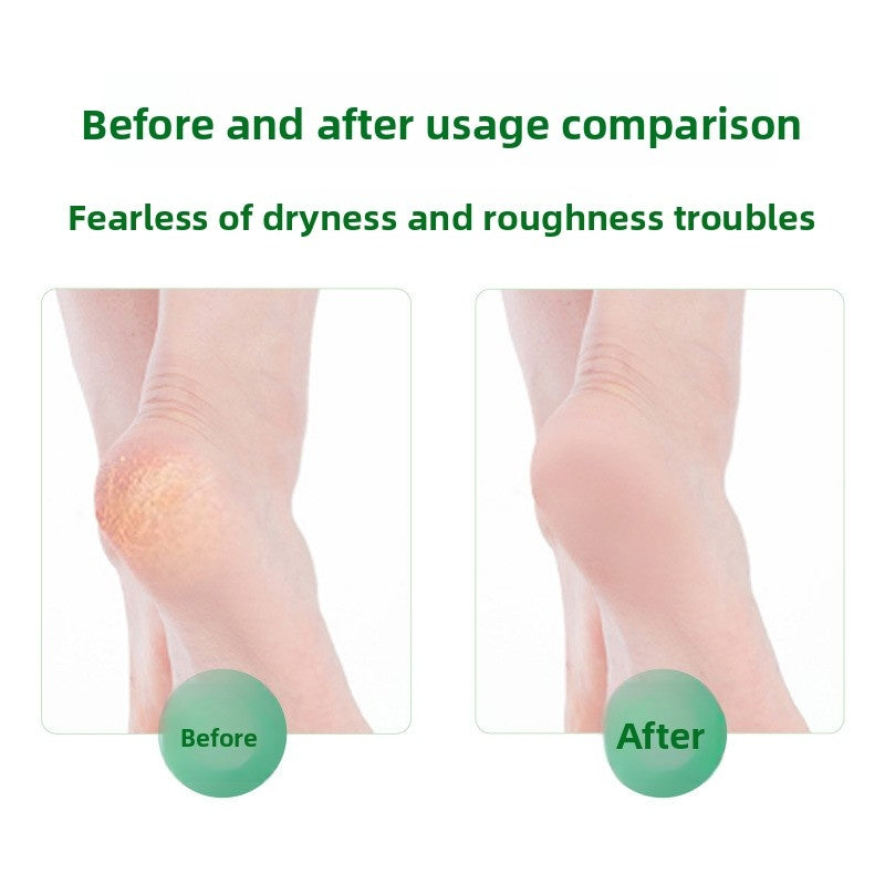 Antibacterial Foot Wash For Stinky Feet With 360° Brush